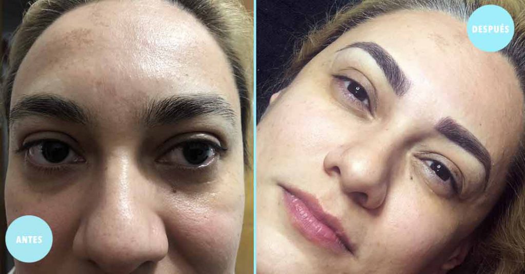 Microblading de Cejas | Resultado Natural